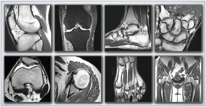 Musculoskeletal Imaging