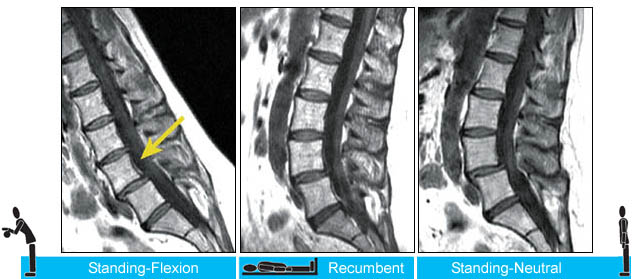 Case #4: Evaluation of Spinal Instability