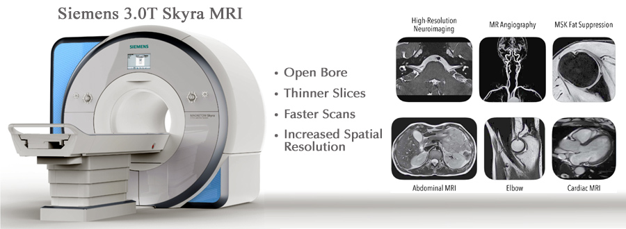 Siemens 3.0T Skyra MRI